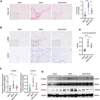 Rifaximin Ameliorates Non-alcoholic Steatohepatitis in Mice Through Regulating gut Microbiome-Related Bile Acids